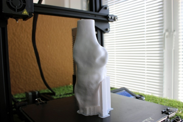 Протез коленного сустава создали в ФабЛабе ТюмГУ 