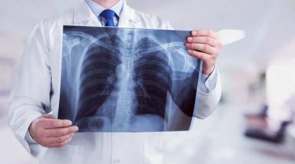 
Образовательный проект тюменских фтизиатров представят на всероссийском уровне
