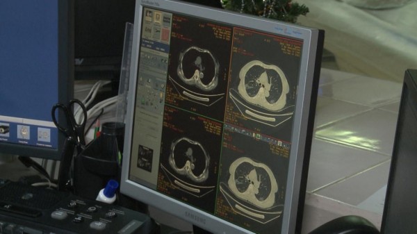 В Тюмени стали проводить операции по эндопротезированию онкопациентам