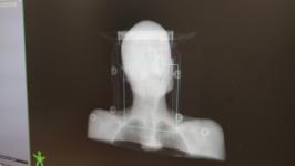 Линейный ускоритель для радиотерапии установили в Медицинском городе в Тюмени