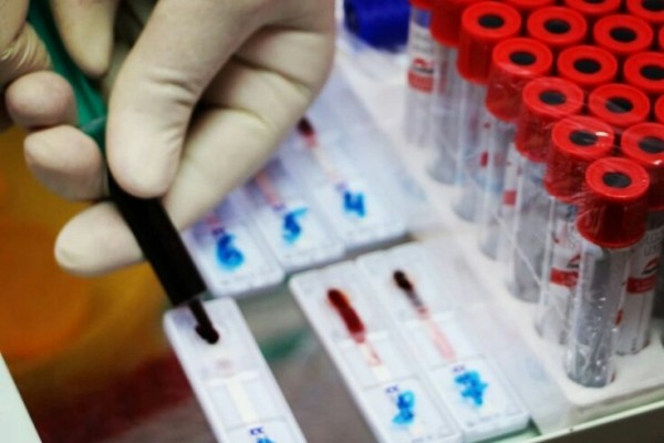 Тюменцы могут пройти тестирование на ВИЧ и получить подарок 