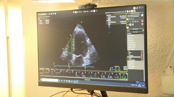 Пандемия COVID-19 придала импульс развитию ультразвуковой диагностики сердца