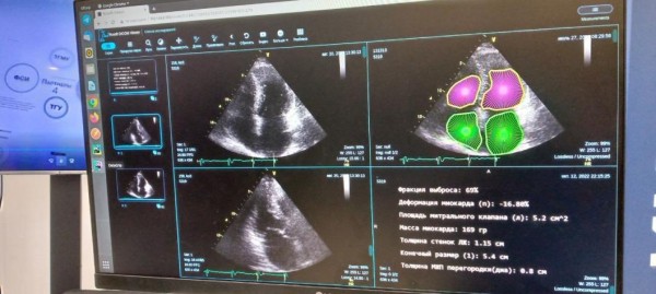 Тюменская ИТ-компания готова к тестированию своего ПО для аппаратов УЗИ Тюменская ИТ-компания готова к тестированию своего ПО для аппаратов УЗИ