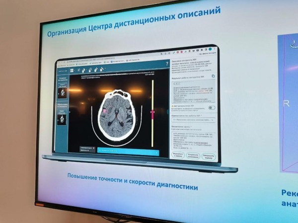 В Тюмени разрабатывают алгоритм для автоматического определения степени тяжести поражения коронарных сосудов