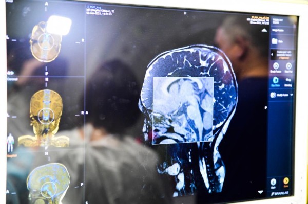 Джинна Лебедева назвала методы лечения головной боли без лекарств