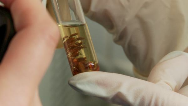 Более 70 тюменцев ежедневно обращаются в медучреждения с укусами от клещей