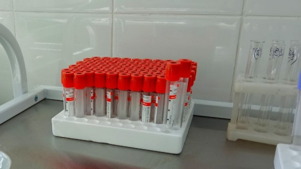 В двух населенных пунктах Тюменской области ввели карантин по бешенству животных В двух населенных пунктах Тюменской области ввели карантин по бешенству животных